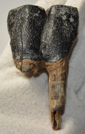 Orrszarvú részleges alsó fog 